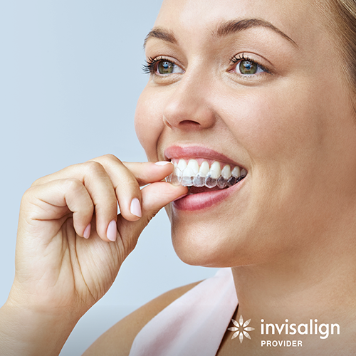 Social Female Aligner1