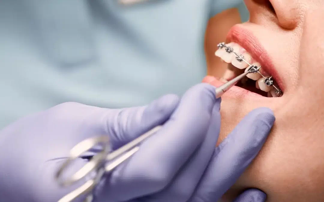 Orthodontic Emergencies in Wyndham Vale: What to Do Before Your Appointment