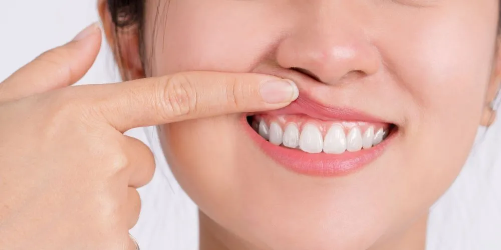The Top 10 Signs You Should Visit a Periodontist in Werribee